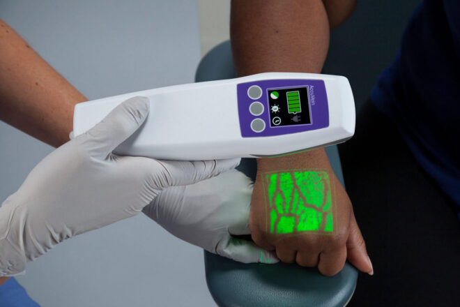 Vein finder.